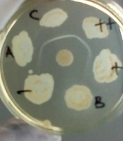 Jundishapur J Microbiol